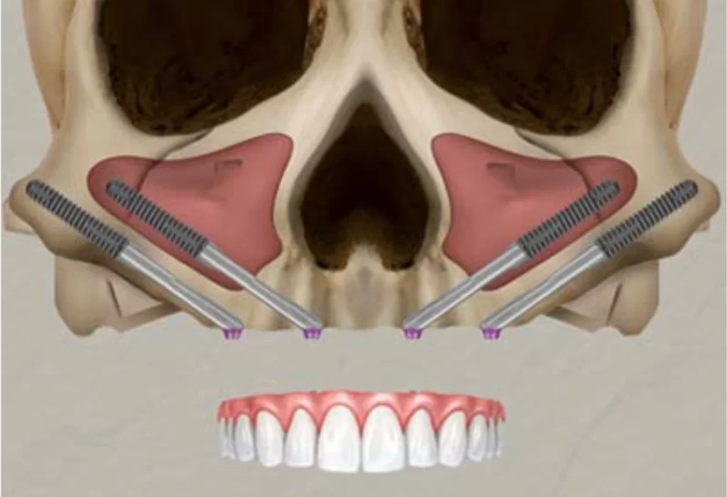 Best smile makeover 